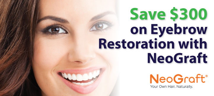Save $300 on Neograft Eyebrow Restoration