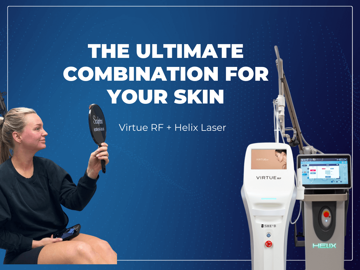 Virtue RF and Helix Laser #1 Combination Therapy