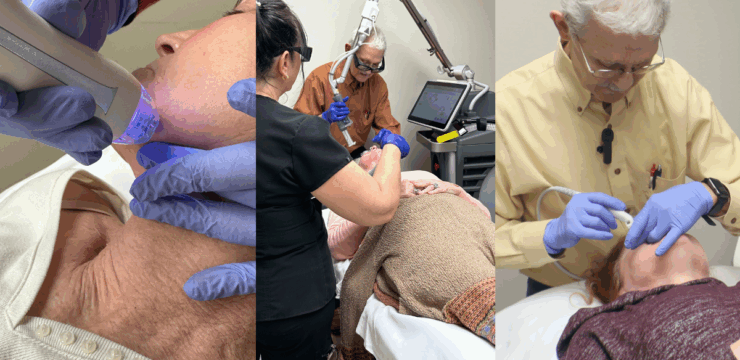 Non Surgical Facial Skin Rejuvenation with Laser & RF Treatments in Savannah, GA