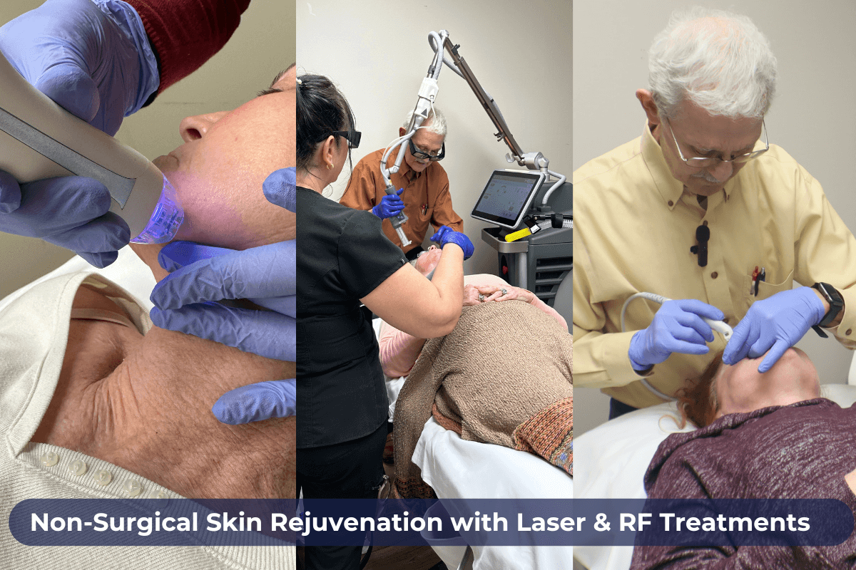 Non Surgical Facial Skin Rejuvenation with Laser & RF Treatments in Savannah, GA