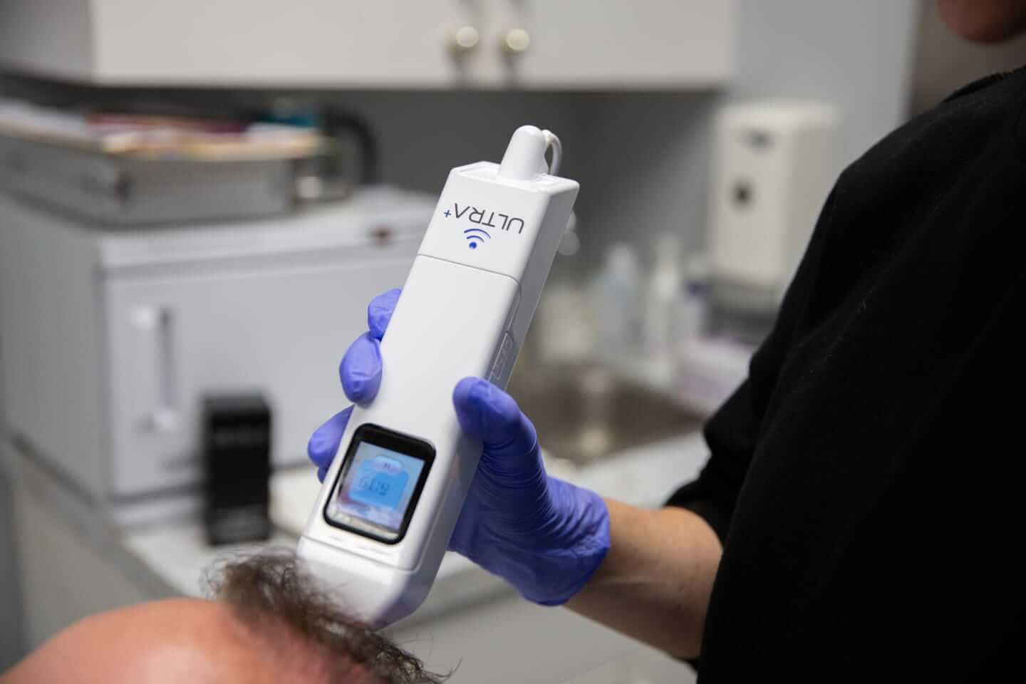 A Modern Needle Free and Pain Free Approach to New Hair Growth at Finger and Associates