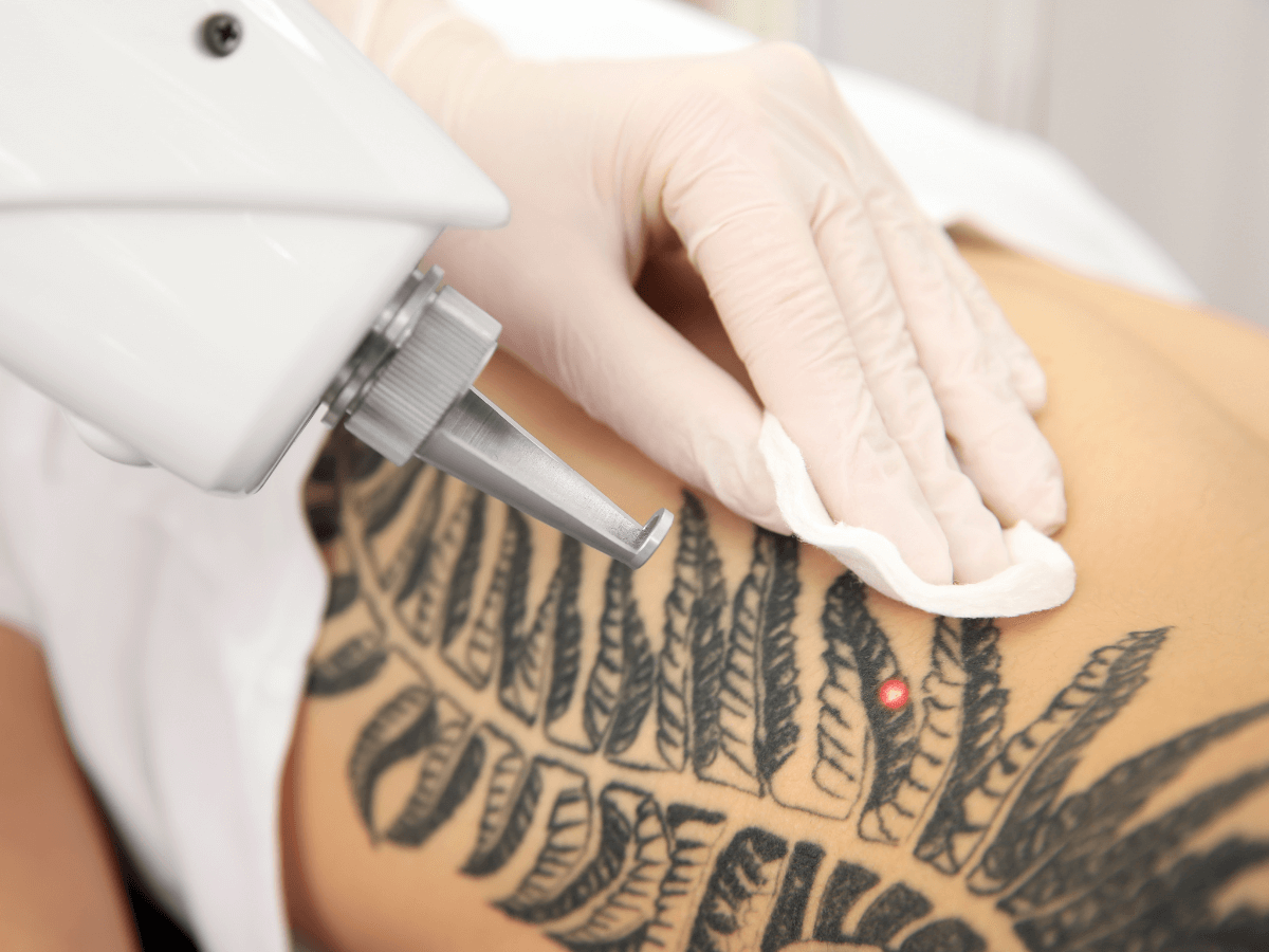 Chrome Lase Station at Finger and Associates