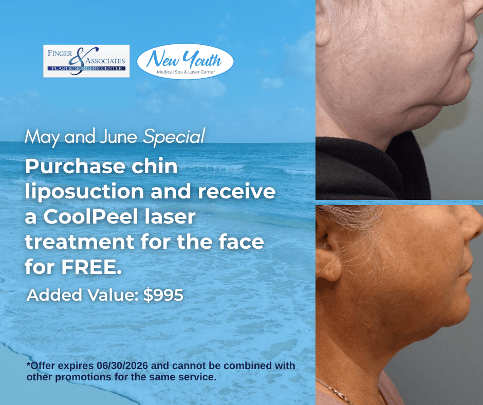 Purchase chin liposuction and receive a complimentary CoolPeel treatment for the face Purchase chin liposuction and receive a complimentary CoolPeel treatment for the face